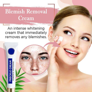 Powerful Whitening Freckle Cream